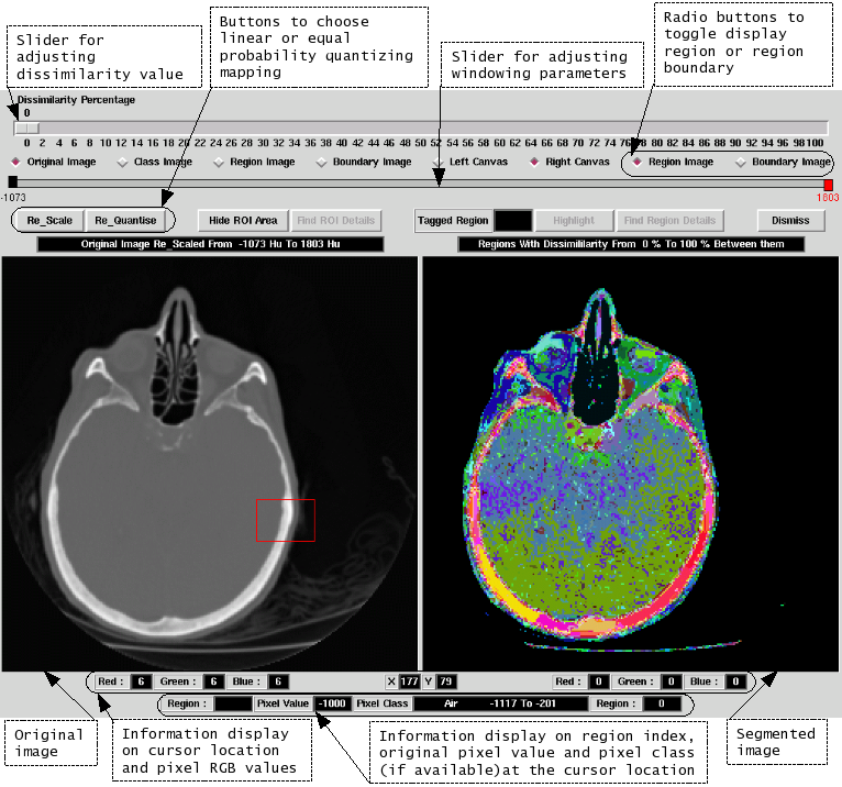 MedicalSegmentationGui.png